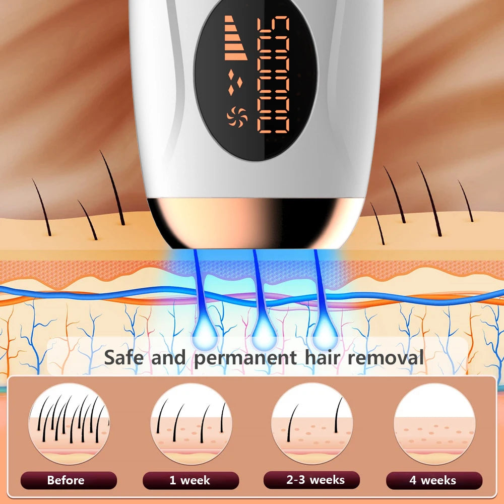 Advanced Portable IPL Laser Hair Removal Device - 999,999 Flashes for Pain-Free and Lasting Hair Elimination for Women's Body and Bikini Areas